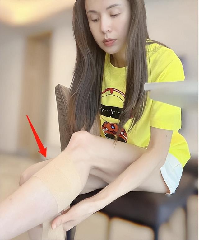 石膏繃帶吧全身骨折小說，繃帶吧 全身石膏圖片？